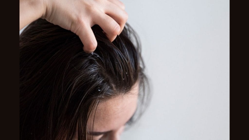 Itchy Scalp and Hair Loss: A Connected Problem