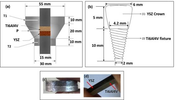 Bi-layered Single-Piece Dental Implant May Reduce Need for Additional Surgeries